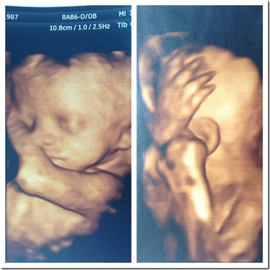 28 week ultrasound